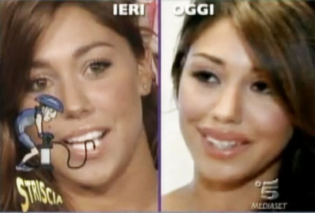 Primo piano di Belen Rodriguez con labbra dal volume definito e sorriso naturale