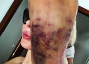 Nina Moric incidente
