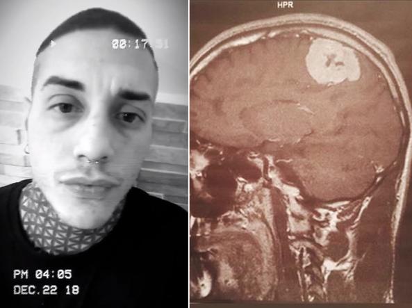 Francesco Chiofalo di Temptation ha un tumore al cervello la rivelazione shock